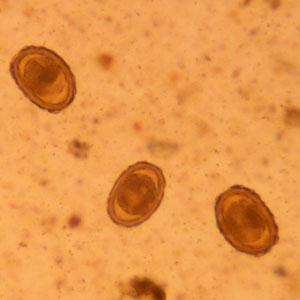 Embryonated Ascaris eggs from an infested gorilla