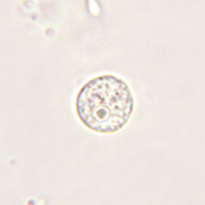 Endolimax nana cyst