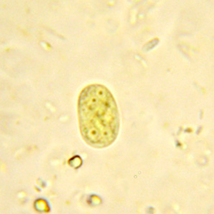 Endolimax nana cyst stained with Lugol