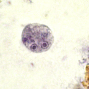 Endolimax nana cyst stained with trichrome