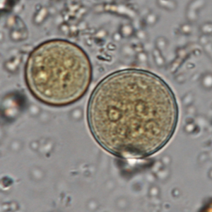 Entamoeba coli cyst
