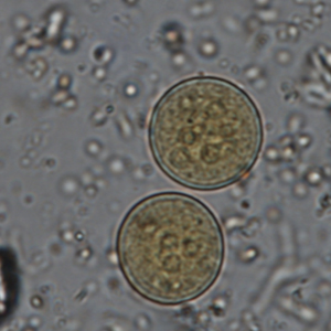 Entamoeba coli cyst