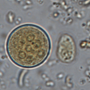 Entamoeba coli cyst