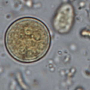 Entamoeba coli cyst