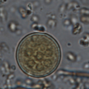Entamoeba coli cyst
