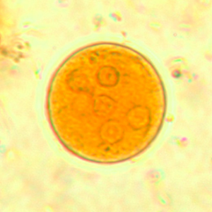Entamoeba coli cysts stained with Lugol