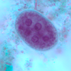 Entamoeba coli cysts stained with trichrome