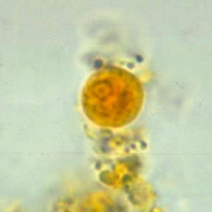 Entamoeba hartmanni cyst stained with Lugol