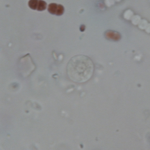 Entamoeba hartmanni cyst