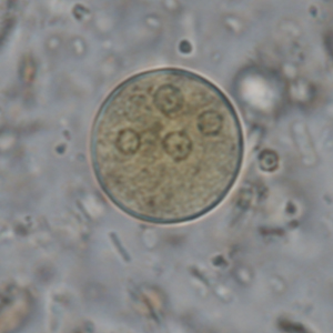 Entamoeba histolytica cyst
