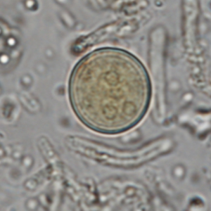 Entamoeba histolytica cyst