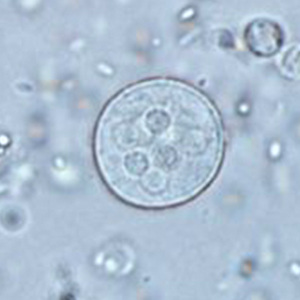 Entamoeba histolytica cyst