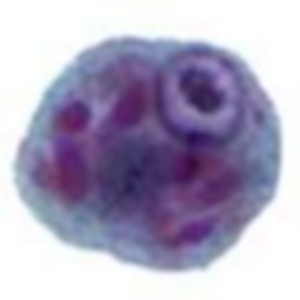 Entamoeba polecki cyst stained with trichrome