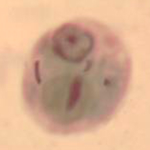 Entamoeba polecki cyst