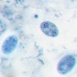 Enteromonas hominis cysts stained with iron hematoxylin