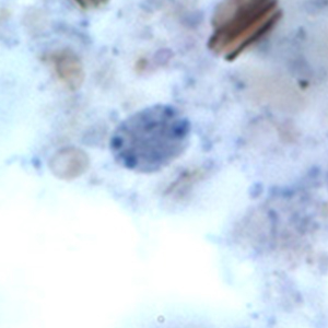 Enteromonas hominis cysts stained with iron hematoxylin