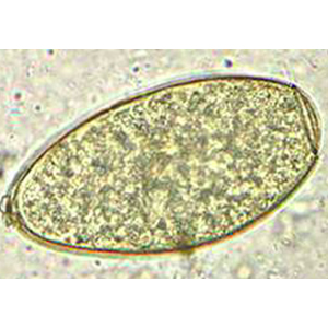 Fasciola hepatica egg