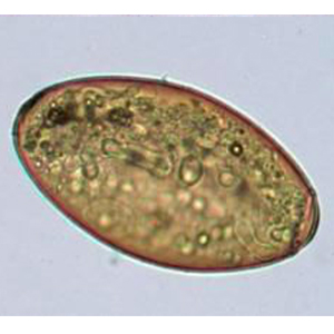 Fasciola hepatica egg