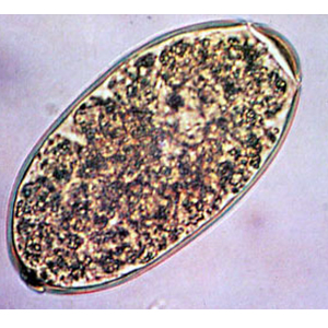 Fasciola hepatica egg