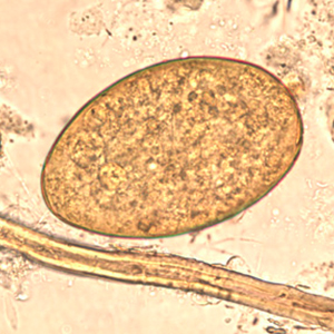 Fasciolospis buksi eggs