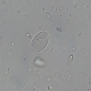 Giardia spp. cyst