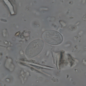 Giardia spp. cyst