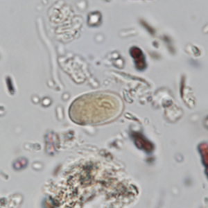 Giardia spp. cysts stained with Lugol