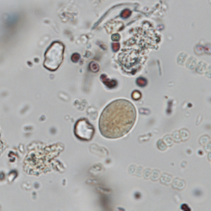 Giardia spp. cysts stained with Lugol