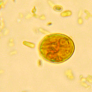 Giardia spp. cysts stained with Lugol