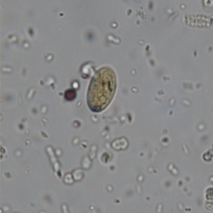 Giardia spp. cysts stained with Lugol