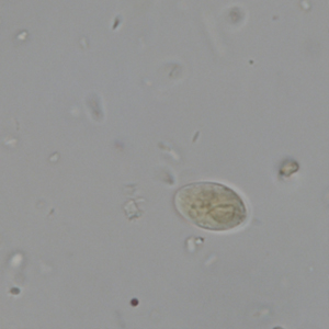 Giardia spp. cysts stained with Lugol