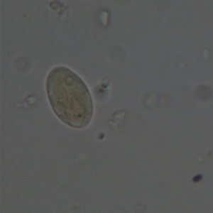 Giardia spp. cysts stained with Lugol