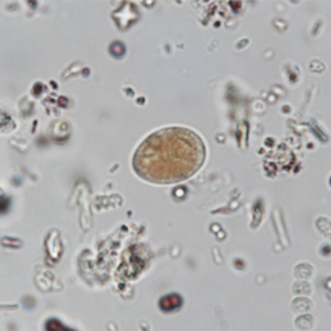 Giardia spp. cysts stained with Lugol