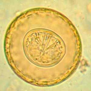 Hymenolepis diminuta egg