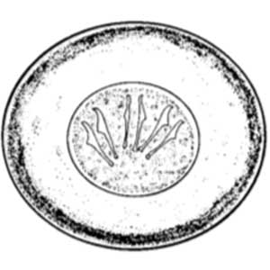 Hymenolepis diminuta egg (Garcia, 2009)