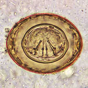 Hymenolepis diminuta egg