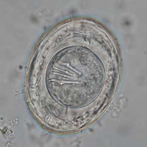 Hymenolepis nana egg