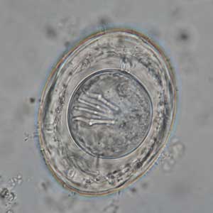 Hymenolepis nana egg