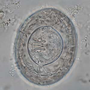 Hymenolepis nana egg