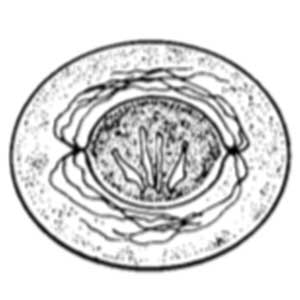 Hymenolepis nana egg (Garcia, 2009)