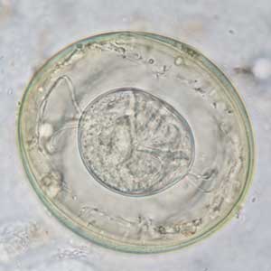 Hymenolepis nana egg stained with Lugol