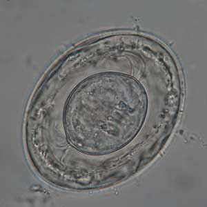 Hymenolepis nana egg