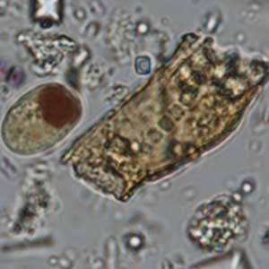 Iodamoeba buschlii cyst stained with Lugol