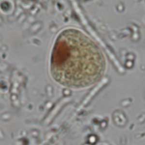 Iodamoeba buschlii cyst stained with Lugol