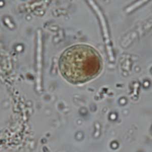 Iodamoeba buschlii cyst stained with Lugol