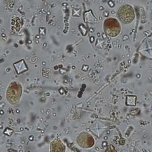 Iodamoeba buschlii cyst stained with Lugol