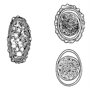 Non embryonated left and embryonated top right Ascaris spp eggs. The egg on the bottom right has lost its outer membrane.