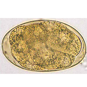 Oesophagostomum spp. egg