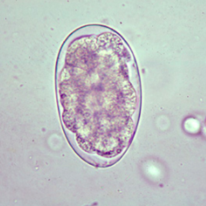 Oesophagostomum spp. egg