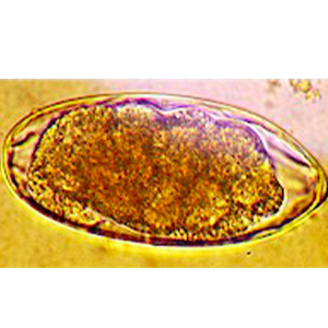 Oesophagostomum spp. egg